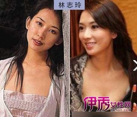 林志玲卖淫，台湾艺人只剩周杰伦正常的了{林志玲为什么中国没人敢要}