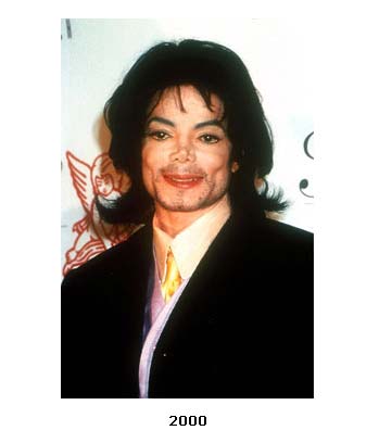 迈克尔杰克逊怎么变白的，迈克杰克逊白斑症图片{迈克尔杰克逊变白的过程}本文共{6127字}