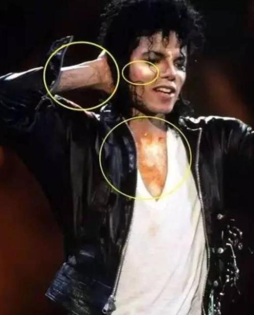 迈克尔杰克逊鼻子,MJ前妻承认孩子是MJ的(迈克尔·杰克逊儿子)
